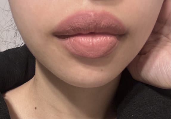 View Gallery Image #10