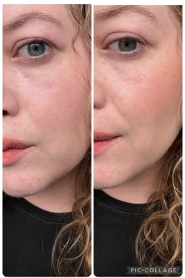 View Gallery Image #11