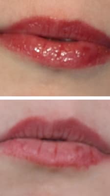 View Gallery Image #1