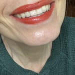 User submitted media 2 of 2