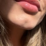 User submitted media 2 of 3