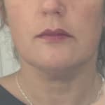 User submitted media 4 of 5