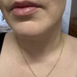 User submitted media 3 of 3