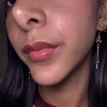 User submitted media 2 of 3