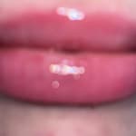 User submitted media 3 of 3