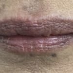 User submitted media 3 of 3