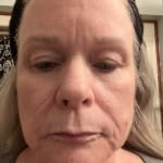 User submitted media 1 of 3