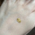 User submitted media 3 of 3