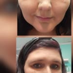 User submitted media 2 of 2