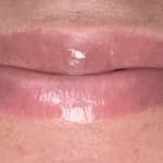 User submitted media 2 of 2