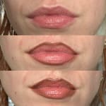 User submitted media