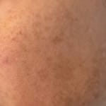 User submitted media 3 of 4