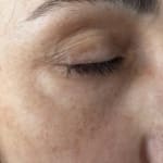 User submitted media 3 of 3