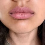 User submitted media 2 of 2