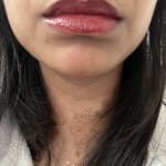 User submitted media 2 of 2