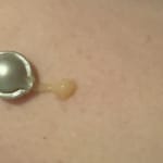 User submitted media 2 of 3