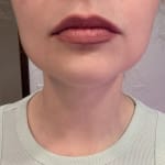 User submitted media 2 of 2