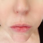 User submitted media 2 of 3