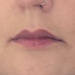 User submitted media 2 of 5