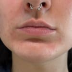 User submitted media 1 of 2