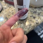 User submitted media 1 of 2