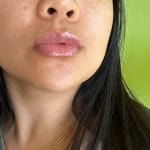 User submitted media 1 of 2