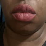 User submitted media 1 of 2