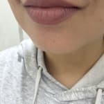 User submitted media 2 of 2