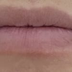 User submitted media 3 of 3