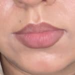 User submitted media 1 of 3