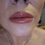 User submitted media