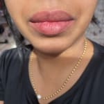 User submitted media 1 of 4