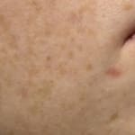 User submitted media 1 of 3