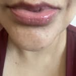 User submitted media 1 of 2