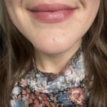 User submitted media 2 of 3