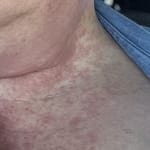 User submitted media 3 of 4