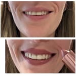 User submitted media 2 of 2