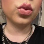 User submitted media 3 of 3