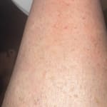 User submitted media 3 of 3