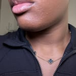 User submitted media 1 of 2