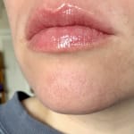 User submitted media 2 of 2