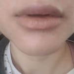 User submitted media 2 of 3