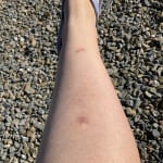 User submitted media 2 of 2