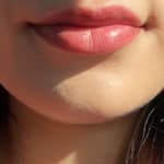 User submitted media 2 of 2