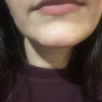 User submitted media 2 of 2