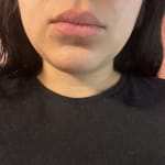 User submitted media 2 of 3