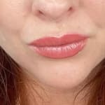 User submitted media 2 of 2