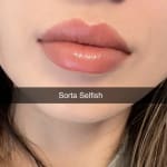 User submitted media 1 of 4