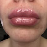 User submitted media 1 of 2