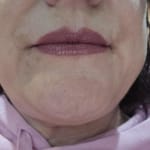 User submitted media 2 of 2